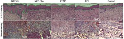 Microneedle Array Patch Made of Kangfuxin/Chitosan/Fucoidan Complex Enables Full-Thickness Wound Healing